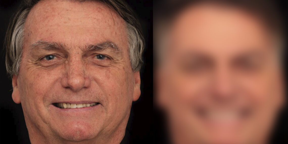 Bolsonaro realiza harmonização e resultado viraliza; veja antes e depois 1