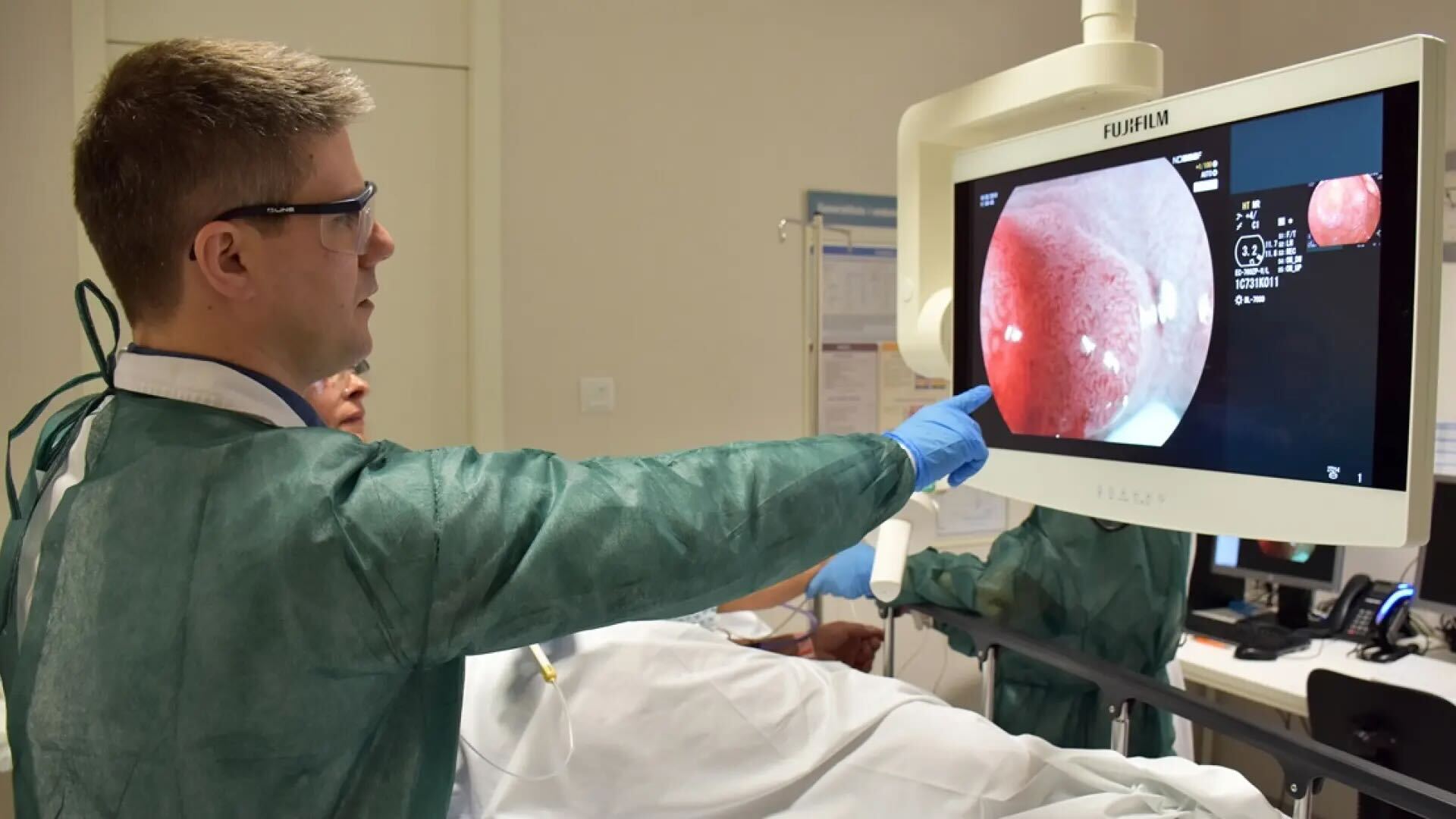 Casos de câncer colorretal preocupa médicos