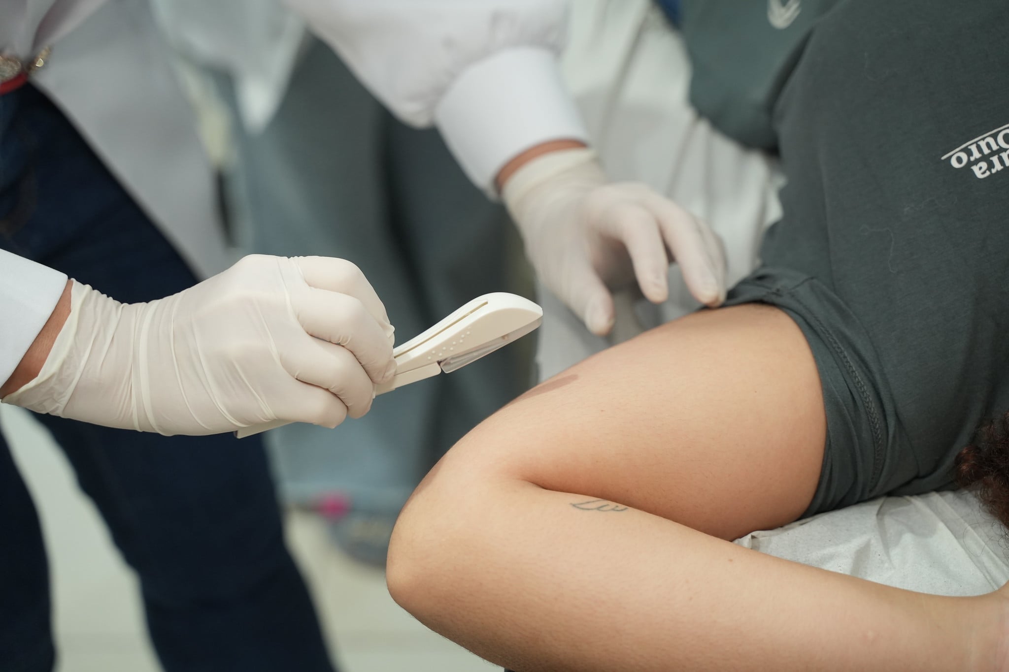 Anvisa aprova ampliação do uso de Implanon para 5 anos
